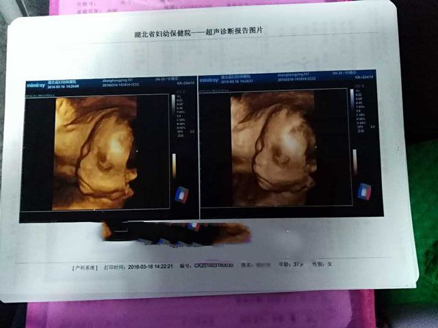 ���ݴ���